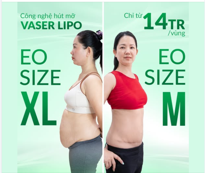 EO SIZE XL EO SIZE M