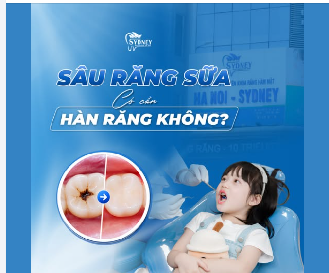 SÂU RĂNG SỮA CÓ CẦN HÀN RĂNG KHÔNG?