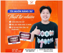 "Tôi Muốn Răng Sứ Thật Tự Nhiên" - Chúng Tôi Có Câu Trả Lời Cho Bạn!