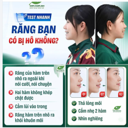 TEST NHANH 3 GIÂY: RĂNG BẠN CÓ ĐANG BỊ HÔ KHÔNG?