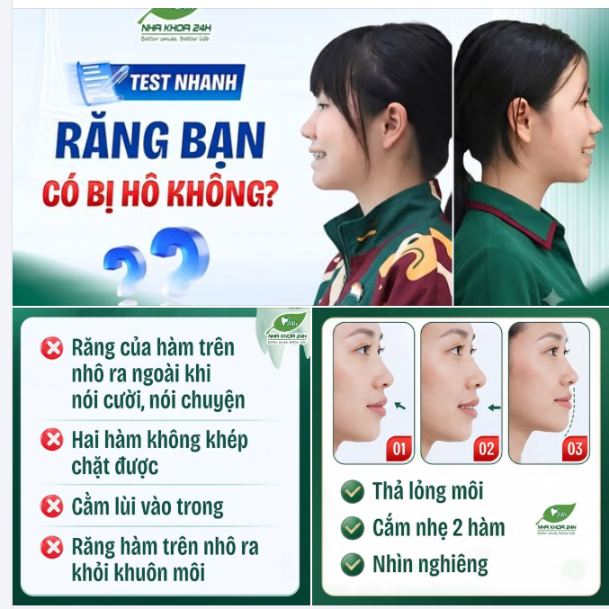 TEST NHANH 3 GIÂY: RĂNG BẠN CÓ ĐANG BỊ HÔ KHÔNG?