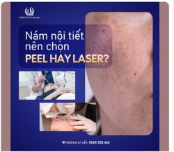 NÊN PEEL HAY DÙNG LASER?