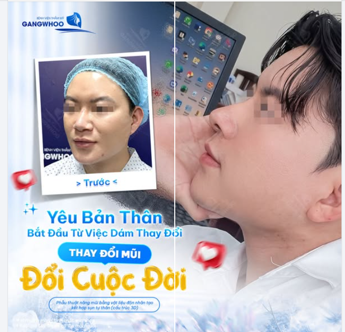 YÊU BẢN THÂN BẮT ĐẦU TỪ VIỆC DÁM THAY ĐỔI