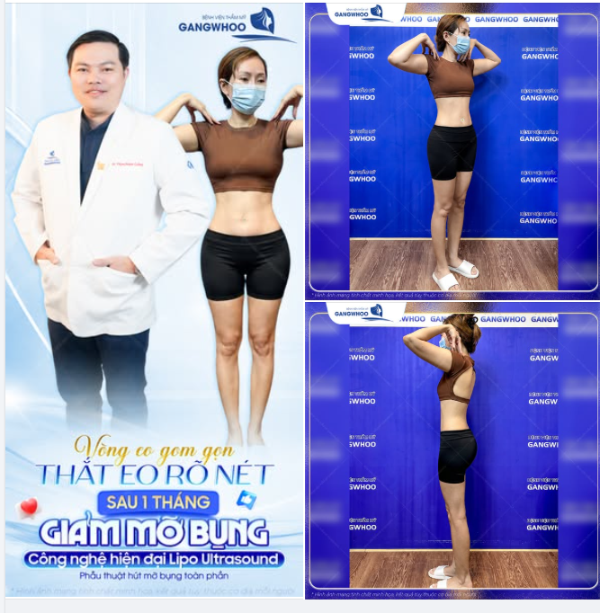 VÒNG EO GOM GỌN, THẮT EO RÕ NÉT