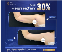 HÚT MỠ TAY - TRỢ GIÁ NGAY LÊN ĐẾN 30%