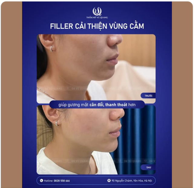 Thăng hạng góc nghiêng chỉ sau 30 phút!