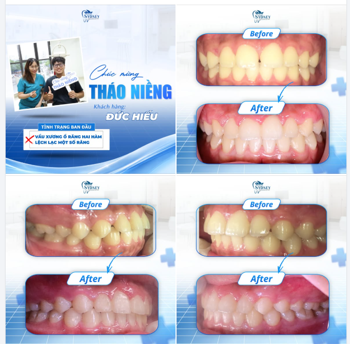 CHÚC MỪNG THÁO NIỀNG KH. ĐỨC HIẾU
