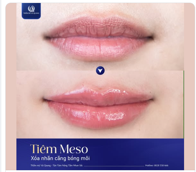 BÍ KÍP SỞ HỮU ĐÔI MÔI CĂNG MỌNG SEXY NHƯ MƠ ƯỚC