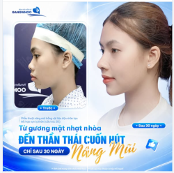TỪ GƯƠNG MẶT NHẠT NHÒA
