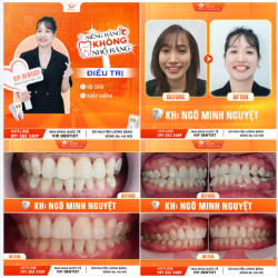 XINH TƯƠI RẠNG RỠ NGÀY THÁO MẮC CÀI CỦA U40!