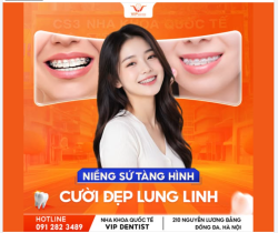 NIỀNG RĂNG MÀ NHƯ KHÔNG NIỀNG – TỰ TIN TỎA SÁNG VỚI MẮC CÀI SỨ THẨM MỸ!