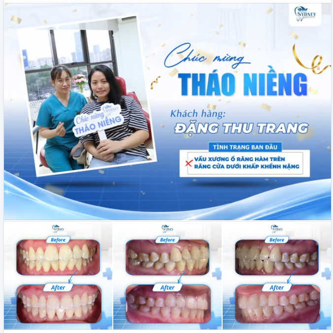 CHÚC MỪNG THÁO NIỀNG KH. THU TRANG
