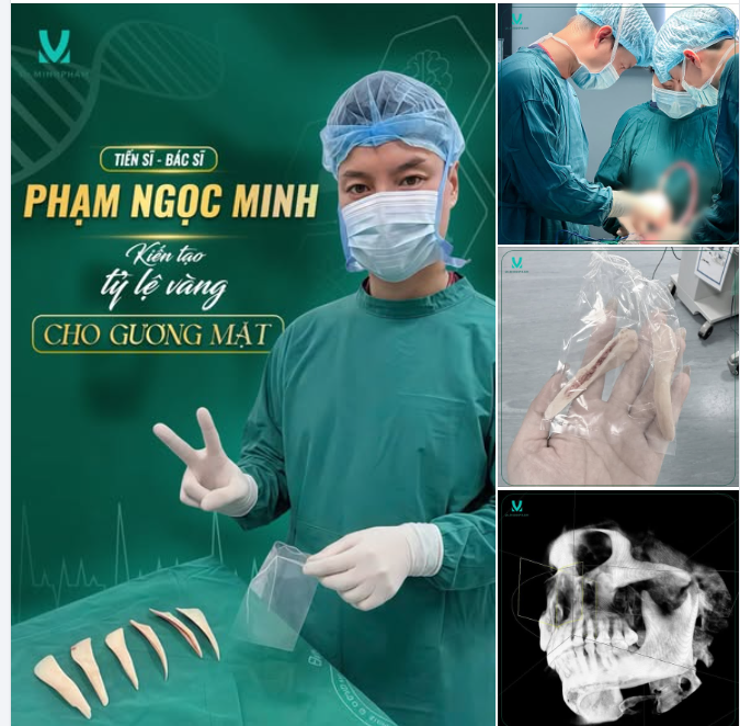 Một gương mặt đẹp không chỉ đến từ từng đường nét riêng lẻ, mà là sự cân đối và hài hòa của tổng thể.
