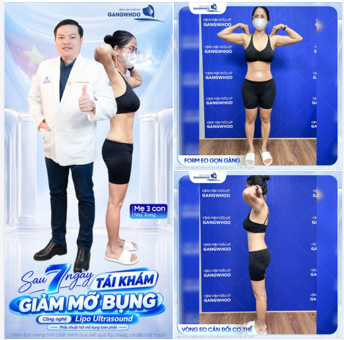 FORM EO GỌN GÀNG VÀ CÂN ĐỐI CƠ THỂ
