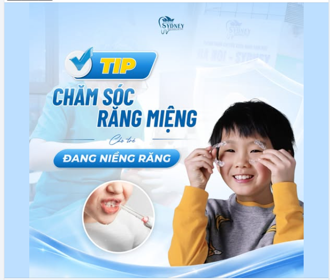 TIPS CHĂM SÓC RĂNG MIỆNG CHO TRẺ ĐANG NIỀNG RĂNG