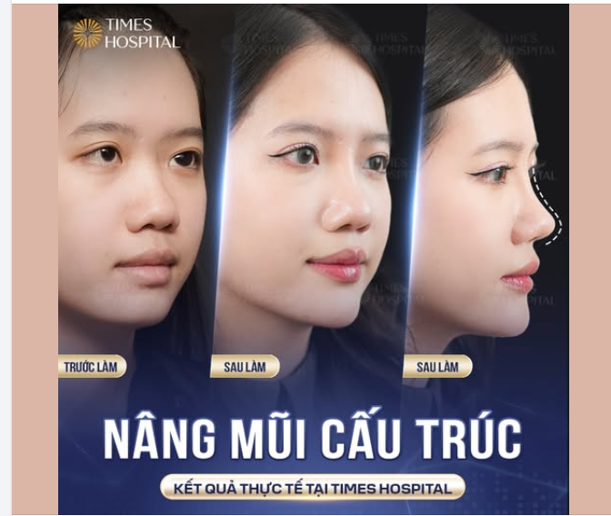 THAY ĐỔI DÁNG MŨI – THAY ĐỔI THẦN THÁI
