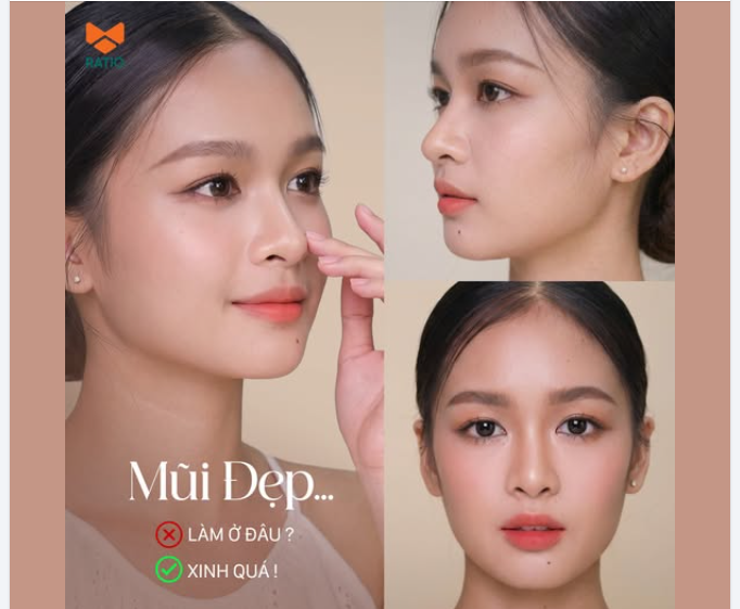 Một chiếc mũi đẹp không phải là khi ai cũng nhận ra bạn vừa nâng mũi.