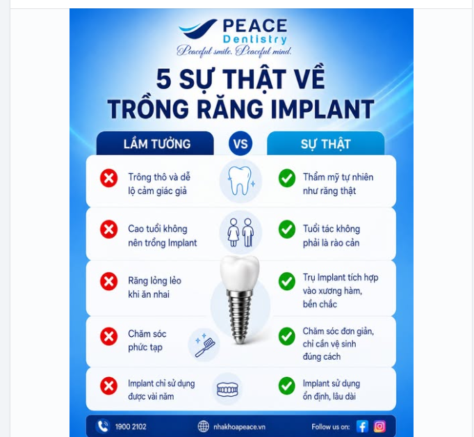 ĐỪNG ĐỂ NHỮNG HIỂU NHẦM KHIẾN BẠN TRÌ HOÃN TRỒNG RĂNG IMPLANT