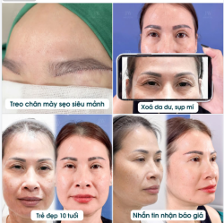 NGỠ NGÀNG VIỆT KIỀU MỸ U50 MẮT HẾT SỤP, TRẺ 10 TUỔI CHỈ SAU 7 NGÀY TREO CHÂN MÀY TẠI JW