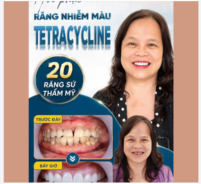 HÀNH TRÌNH KHÔI PHỤC NỤ CƯỜI CỦA CHỊ HÀ – VIỆT KIỀU ÚC