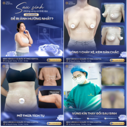 Làm mẹ là một hành trình tuyệt vời, nhưng cũng để lại không ít thay đổi trên cơ thể.
