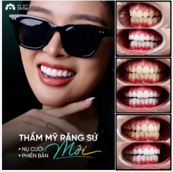 NỤ CƯỜI MỚI – PHIÊN BẢN MỚI CÙNG BÁC SĨ DELIA!