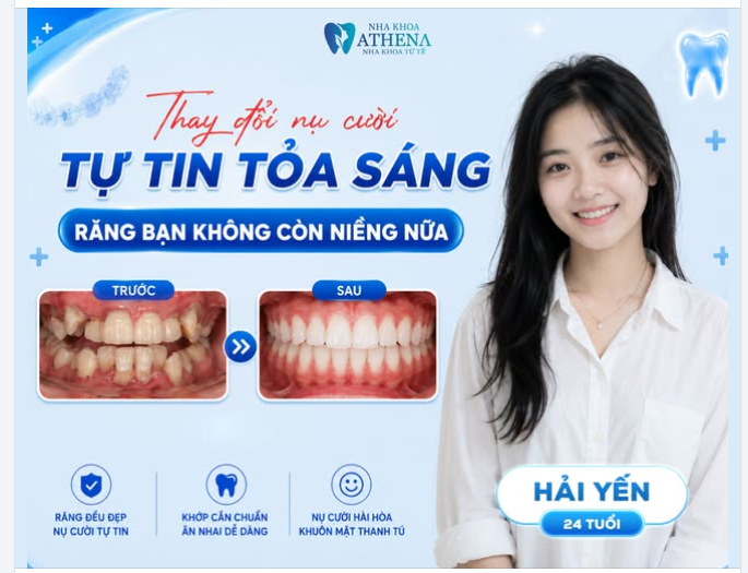 THAY ĐỔI NỤ CƯỜI – TỰ TIN TỎA SÁNG CÙNG HẢI YẾN (24 TUỔI)!