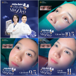 8.8 SĂN TRỢ GIÁ - DEAL MÍ SIÊU HỜI!