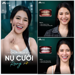 CHỌN NỤ CƯỜI KHỎE ĐẸP - CHỌN DELIA!