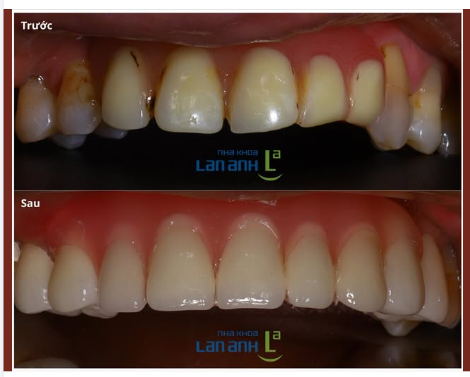 Không phải cứ làm lại tất cả mới gọi là thay đổi!