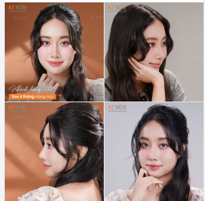 Gen Z ngày nay không chờ đến khi "ổn định" mới làm đẹp. Bởi ngoại hình cũng là một khoản đầu tư cho bản thân.