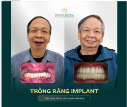 CÁC CON CHỈ MONG BỐ LẠI ĐƯỢC ĂN NGON