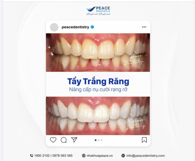 HÃY ĐỂ NỤ CƯỜI TRẮNG SÁNG RẠNG RỠ TRỞ THÀNH ĐIỂM NHẤN TRONG MỌI KHOẢNH KHẮC