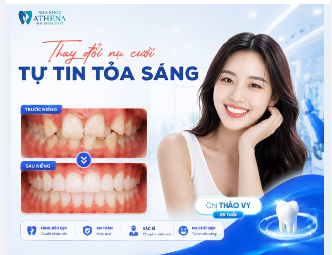 THAY ĐỔI NỤ CƯỜI – TỰ TIN TỎA SÁNG