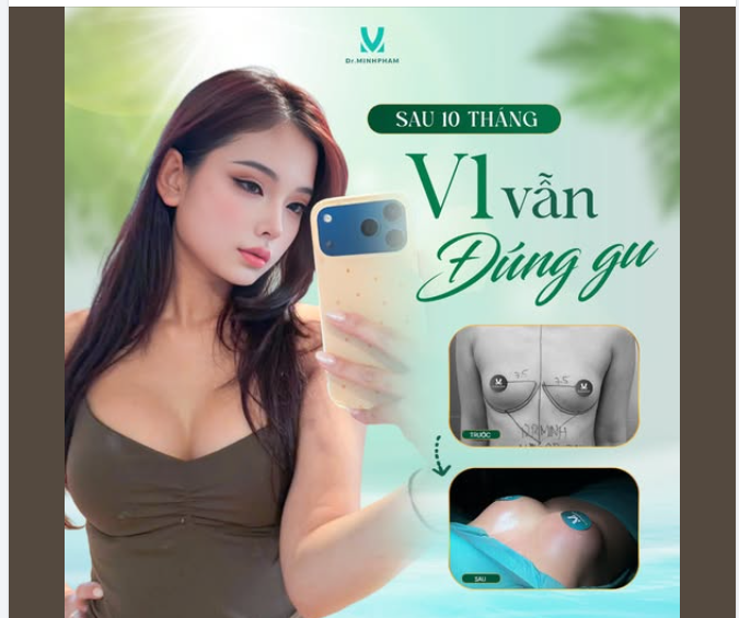 SAU 10 THÁNG – V1 VẪN “ĐÚNG GU”