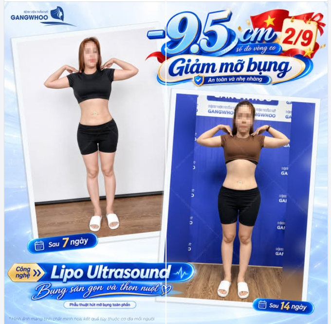 BỤNG SĂN GỌN VÀ THON NUỘT