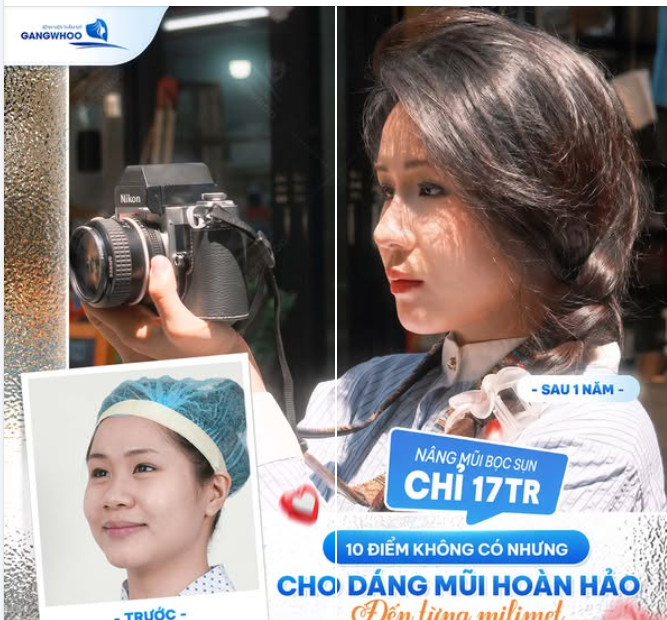 10 ĐIỂM KHÔNG CÓ NHƯNG CHO DÁNG MŨI NÀY