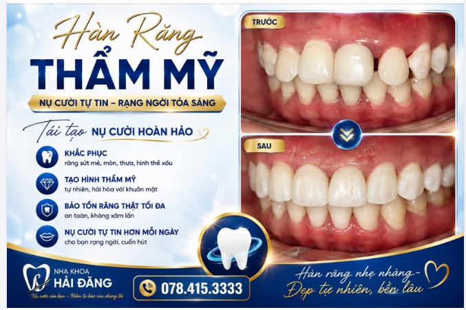TRỊNH THỊ HẬU – HÀN KHE THƯA THẨM MỸ- CƯỜI XINH HƠN MỖI NGÀY