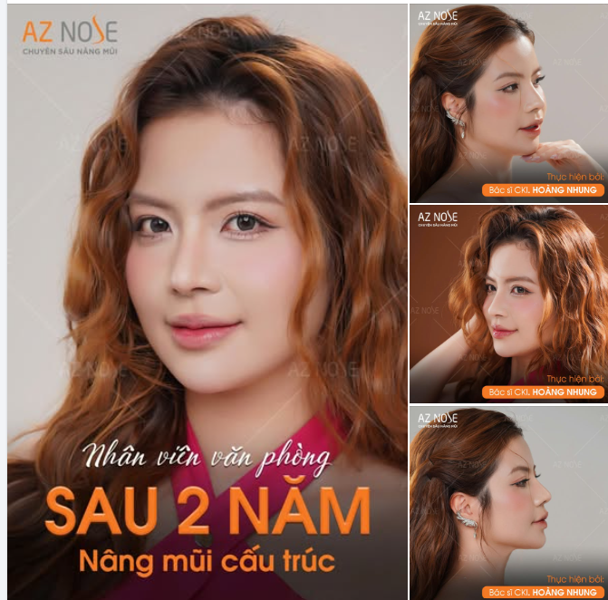 Có ai thấy cổ xinh kiểu "gái Thái" hông