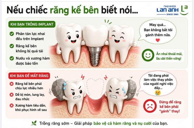 Nếu chiếc răng kế bên biết nói…  “May quá, bạn trồng Implant rồi. Mình không phải gánh thay nữa!”