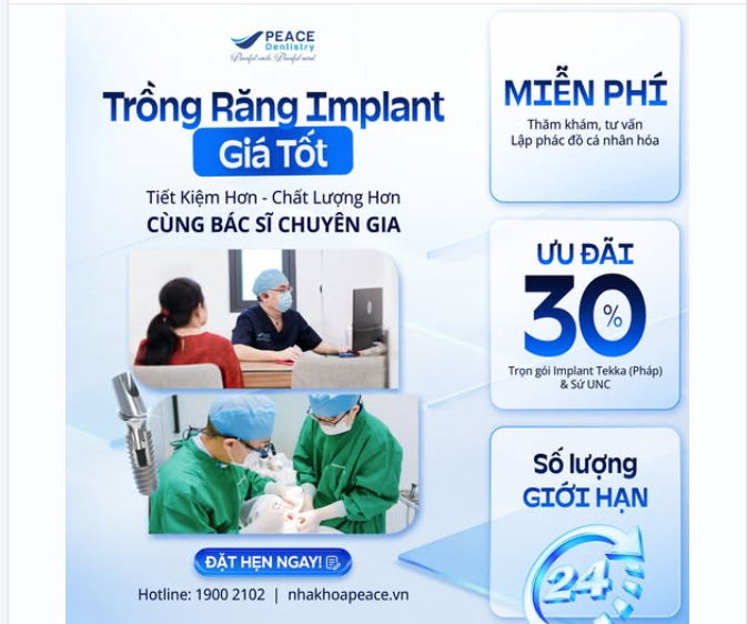 MẤT RĂNG ĐỪNG CHỜ LÂU – TRỒNG IMPLANT ƯU ĐÃI 30%