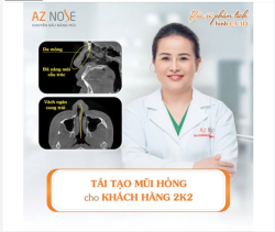 Khách hàng 2K2 đến từ Vũng Tàu từng can thiệp 2 lần - đã sử dụng "sụn tai" cả hai bên.
