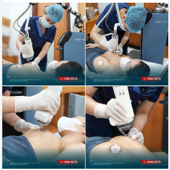 MÓN QUÀ NHỎ – THÊM TRỌN VẸN CHO HÀNH TRÌNH NÂNG CẤP VÒNG 1