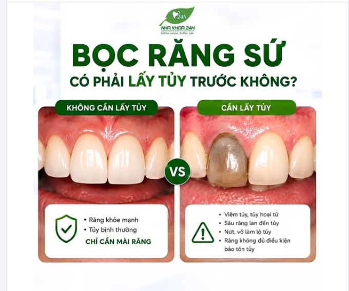 BỌC RĂNG SỨ CÓ BẮT BUỘC PHẢI LẤY TỦY KHÔNG?