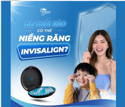 ĐỘ TUỔI NÀO CÓ THỂ NIỀNG RĂNG INVISALIGN?