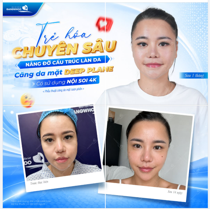 TRẺ HÓA CHUYÊN SÂU – NÂNG ĐỠ CẤU TRÚC LÀN DA