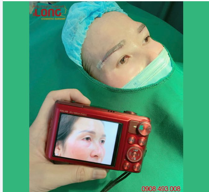 Đôi khi, lý do khách hàng tìm đến PTTM Bác sĩ Long không chỉ dừng lại ở việc sở hữu một đôi mắt ĐẸP.