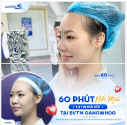 60 PHÚT ĐỔI MŨI - TỰ TIN ĐỔI ĐỜI