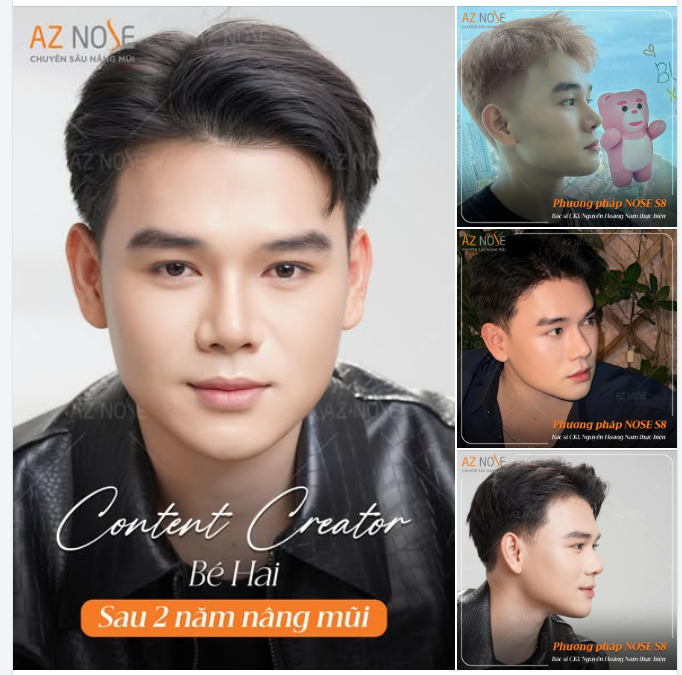 Sau 2 năm nâng mũi, Content Creator Bé Hai tự tin thử sức với những lĩnh vực mới!