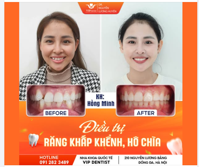 THẦN THÁI TỰ TIN - NỤ CƯỜI CUỐN HÚT!